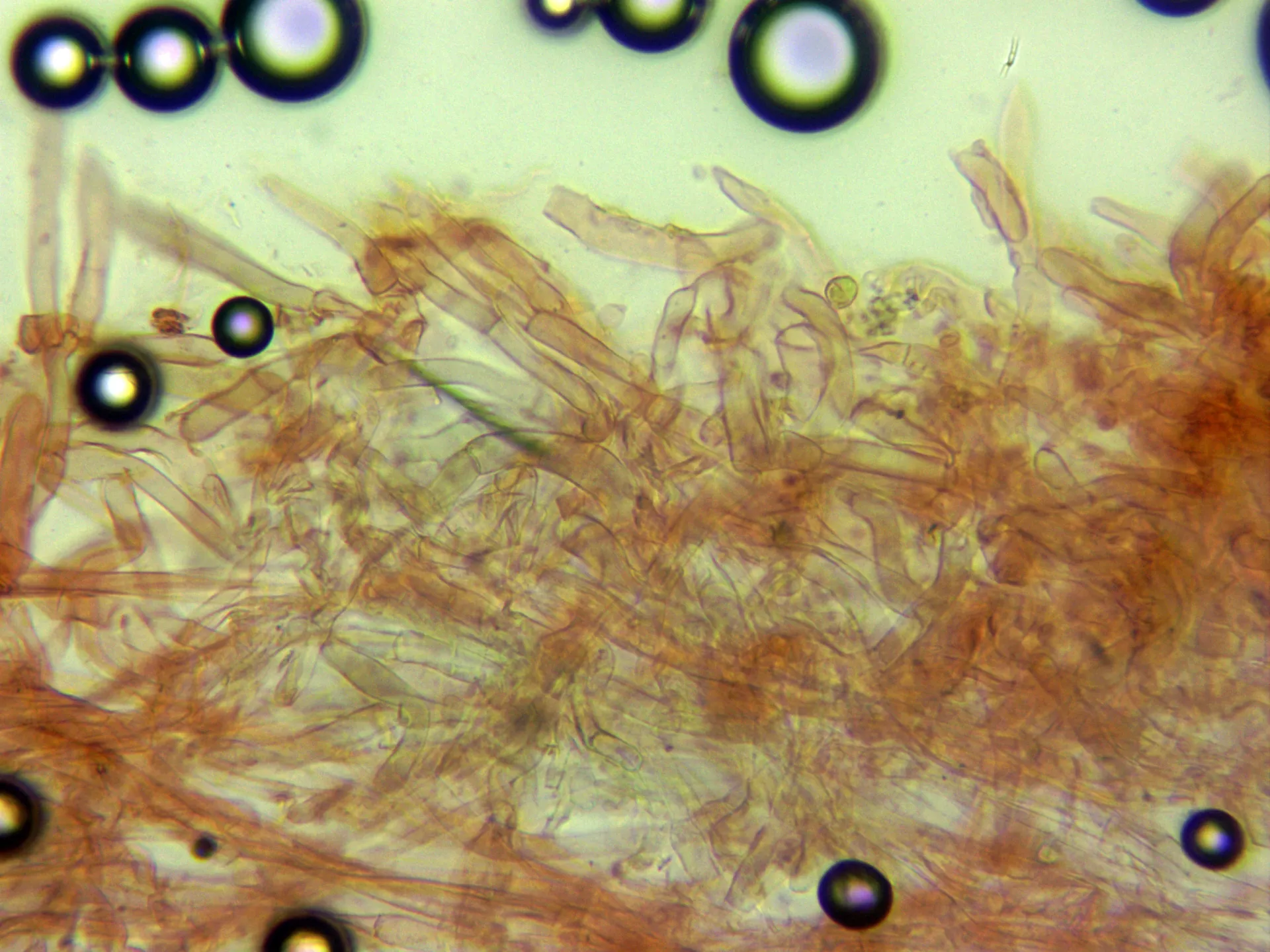 Microscopía de Spodocybe trulliformis - 6 - Cutícula x 400